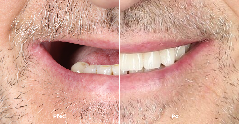 case image